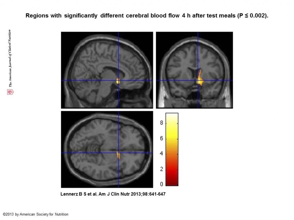 fMRI-bilder